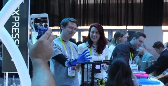 Neural Implants And Robotic Prostheses Enable Disabled Gamers To Keep Gaming