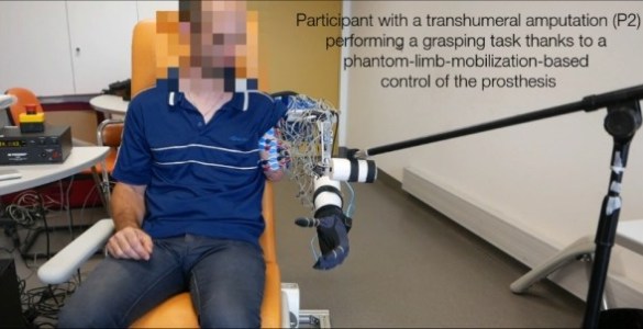 French CNRS Researchers Make Advancements With Bionic Prosthesis For Phantom Limb Amputees